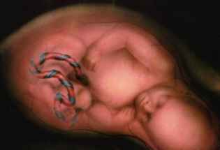 fetus1.jpg